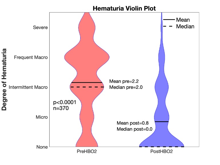 Hematuria