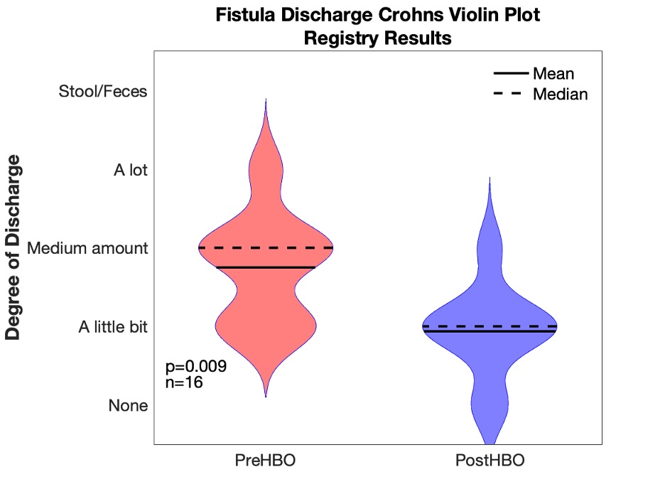 fistula